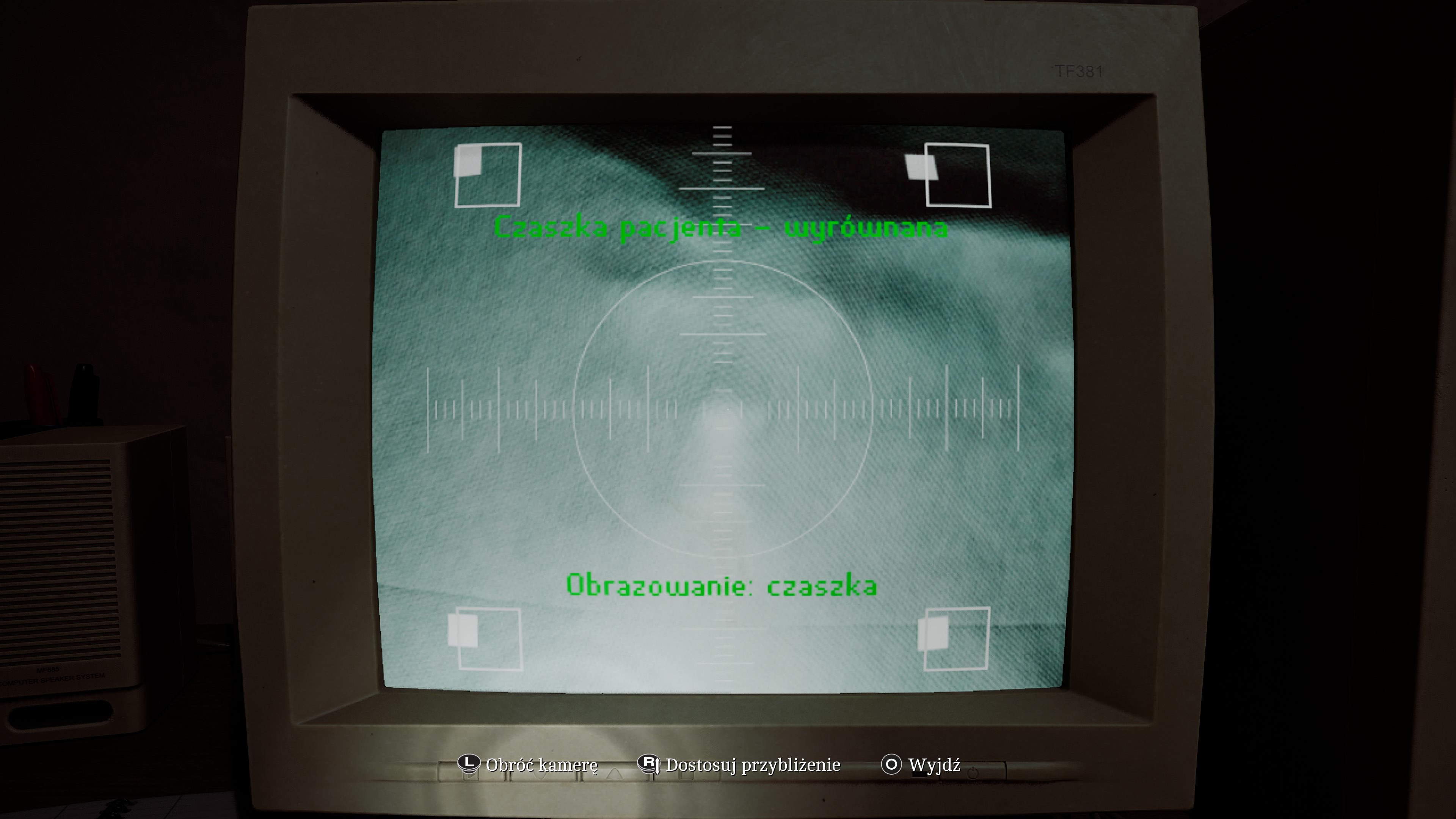 Silent Hill Townall - Pracownia rentgenowska: kod, czaszka, klatka piersiowa, jak zrobić zdjęcia?