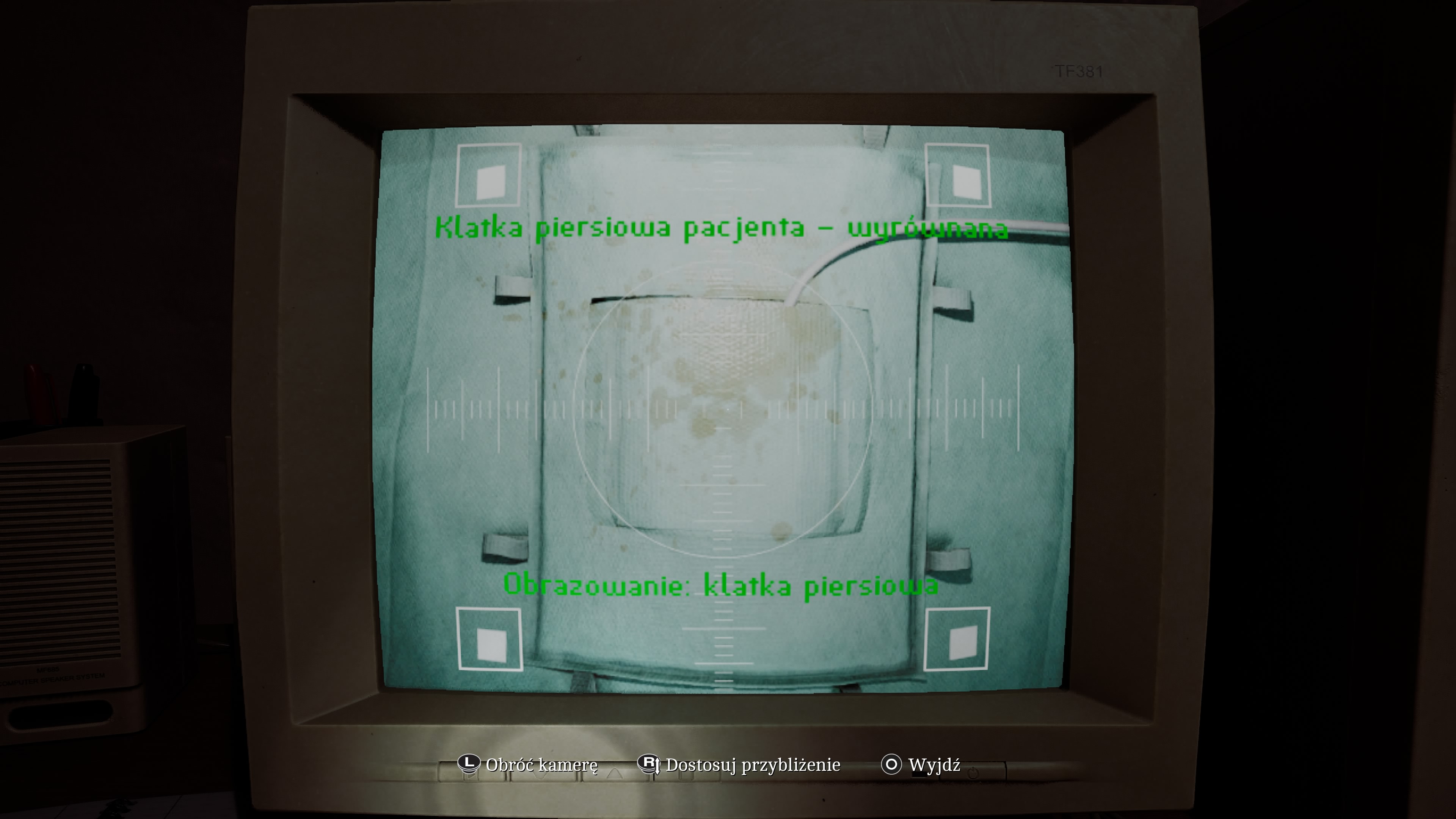 Silent Hill Townall - Pracownia rentgenowska: kod, czaszka, klatka piersiowa, jak zrobić zdjęcia?
