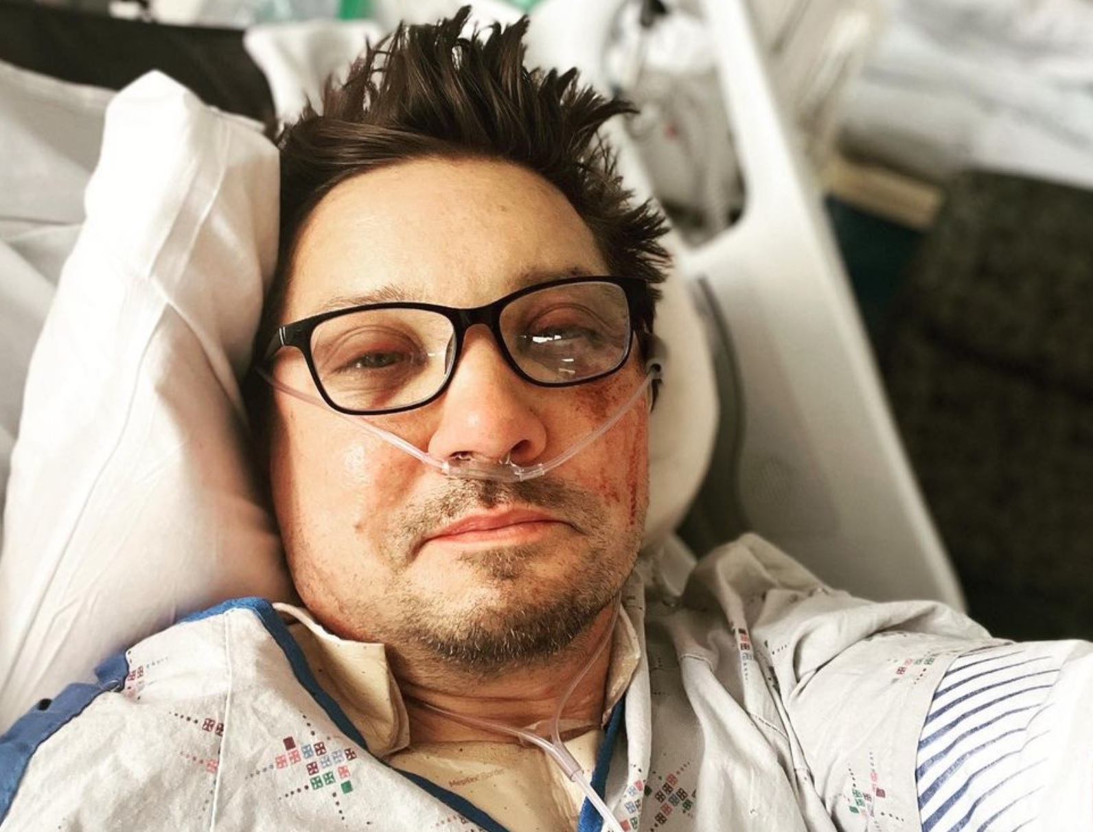 Jeremy Renner po wypadku